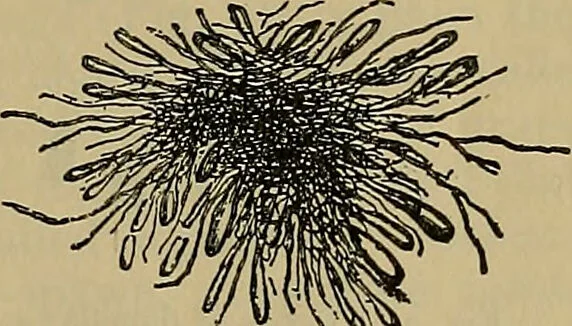 An illustration from Modern surgery, general and operative / by John Chalmers DaCosta., 1914, leaf 19