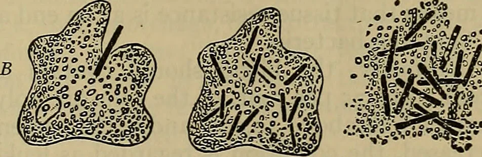 An illustration from Modern surgery, general and operative / by John Chalmers DaCosta., 1914, leaf 41