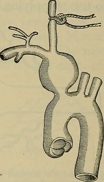 An illustration from Modern surgery, general and operative / by John Chalmers DaCosta., 1914, leaf 436