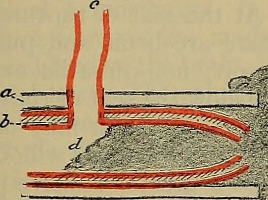 An illustration from Modern surgery, general and operative / by John Chalmers DaCosta., 1914, leaf 445