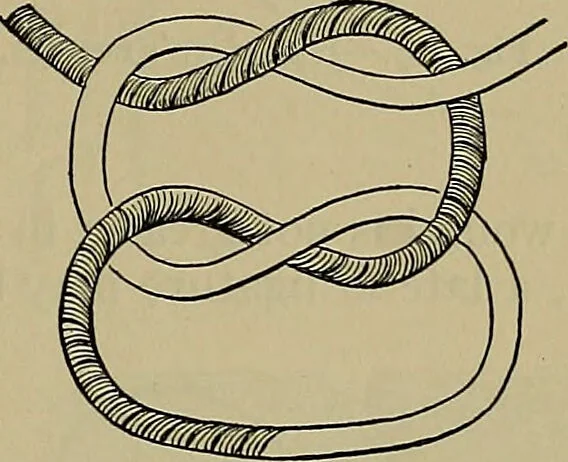 An illustration from Modern surgery, general and operative / by John Chalmers DaCosta., 1914, leaf 449
