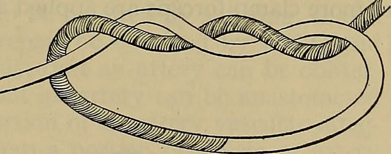 An illustration from Modern surgery, general and operative / by John Chalmers DaCosta., 1914, leaf 449