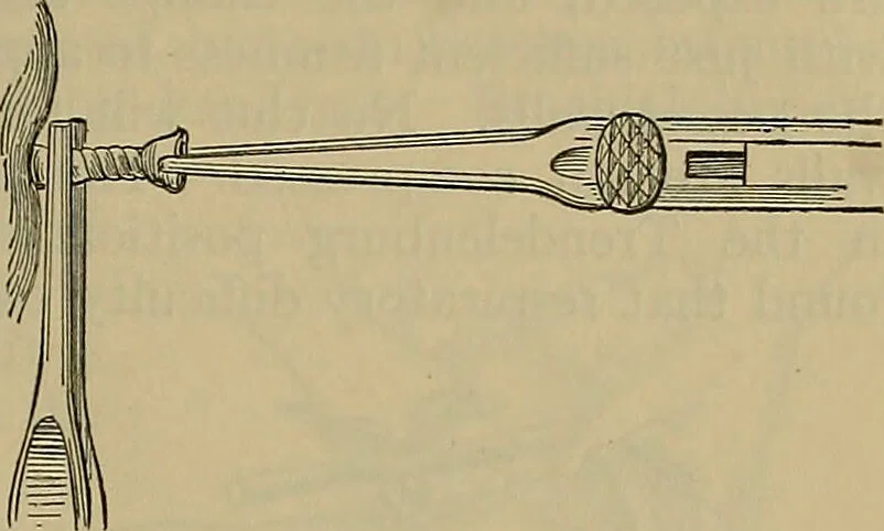 An illustration from Modern surgery, general and operative / by John Chalmers DaCosta., 1914, leaf 455