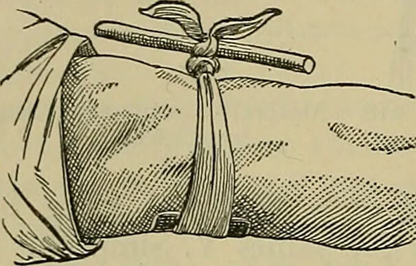 An illustration from Modern surgery, general and operative / by John Chalmers DaCosta., 1914, leaf 456