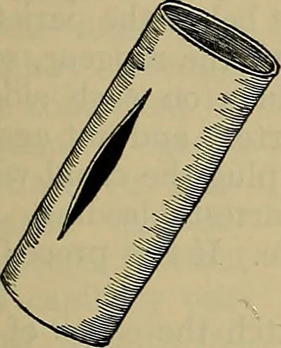 An illustration from Modern surgery, general and operative / by John Chalmers DaCosta., 1914, leaf 461