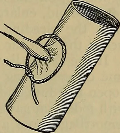 An illustration from Modern surgery, general and operative / by John Chalmers DaCosta., 1914, leaf 461