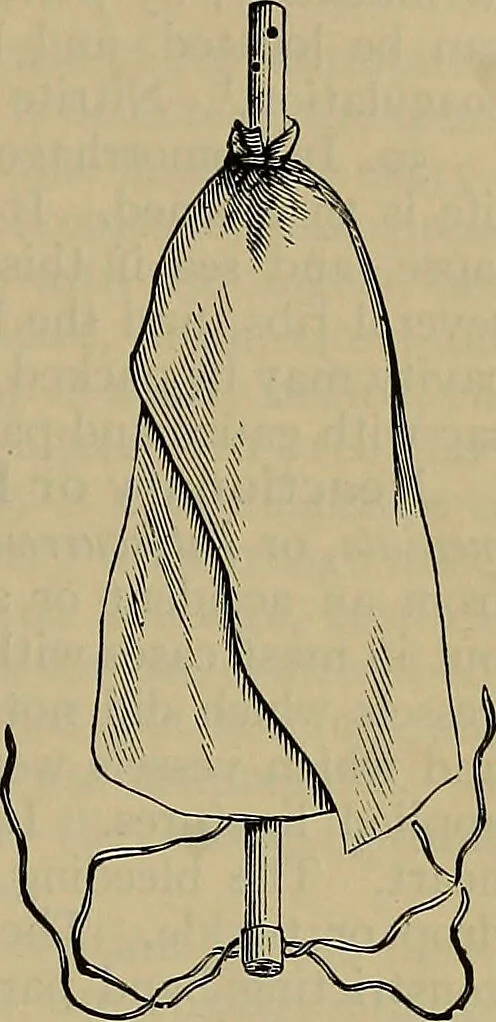 An illustration from Modern surgery, general and operative / by John Chalmers DaCosta., 1914, leaf 465