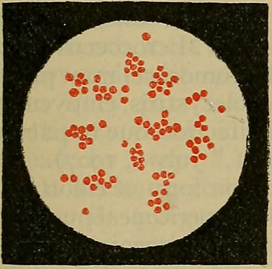 An illustration from Modern surgery, general and operative / by John Chalmers DaCosta., 1914, leaf 51