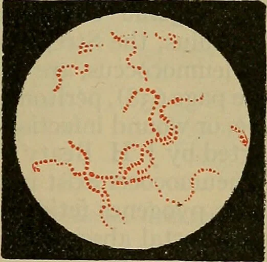 An illustration from Modern surgery, general and operative / by John Chalmers DaCosta., 1914, leaf 51