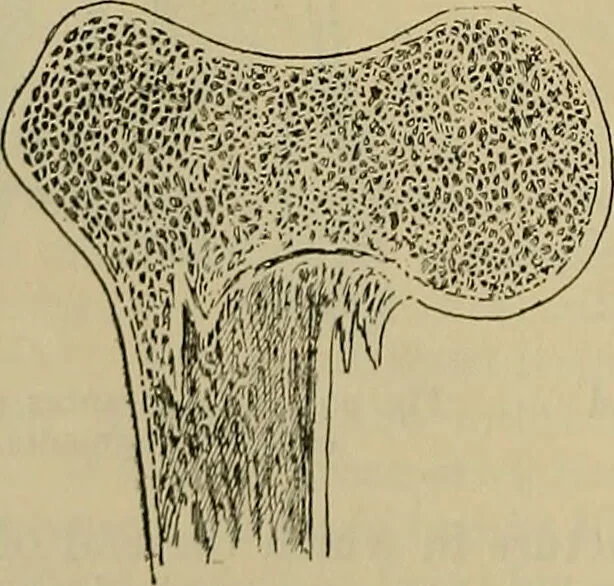 An illustration from Modern surgery, general and operative / by John Chalmers DaCosta., 1914, leaf 534
