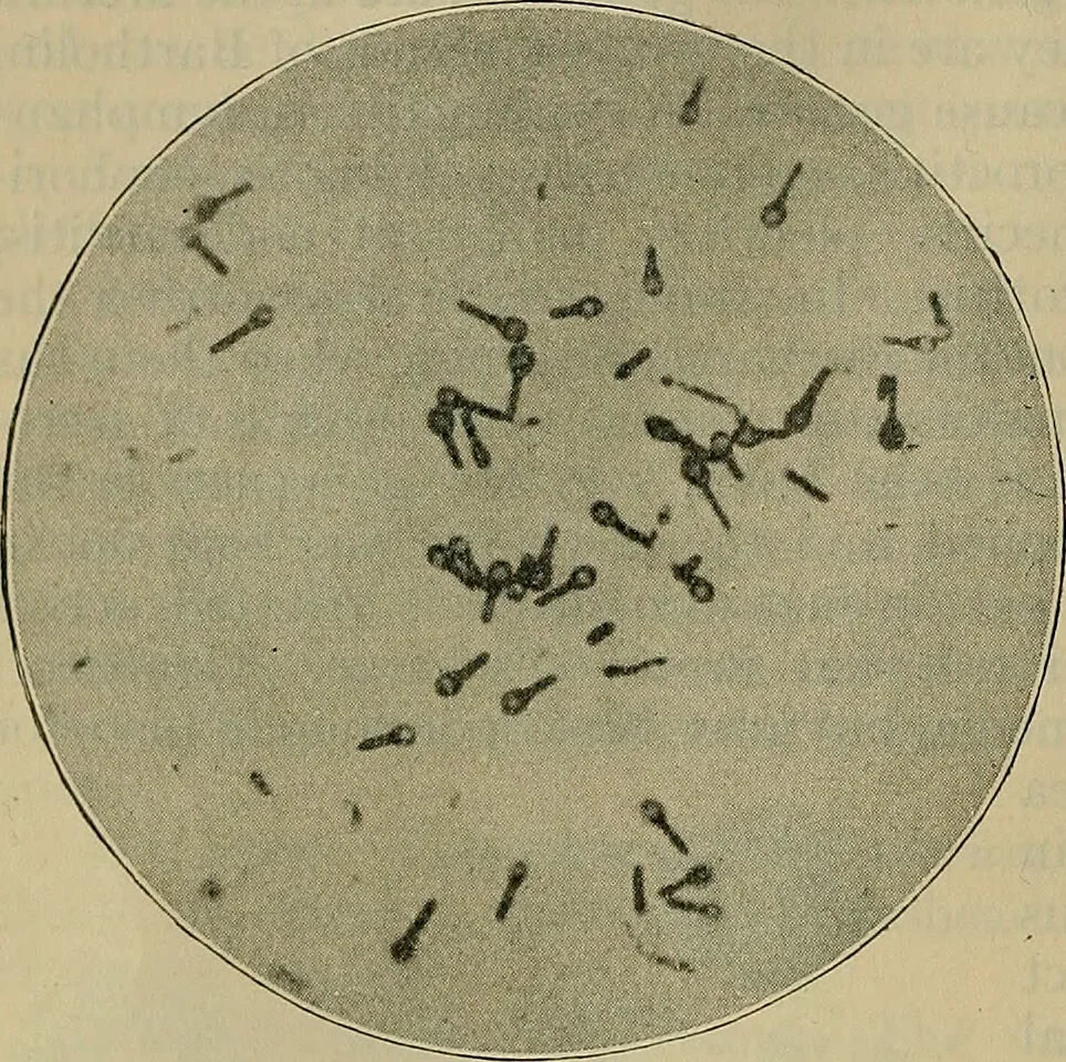 An illustration from Modern surgery, general and operative / by John Chalmers DaCosta., 1914, leaf 54