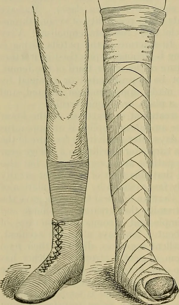 An illustration from Modern surgery, general and operative / by John Chalmers DaCosta., 1914, leaf 548