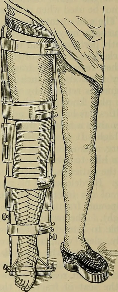 An illustration from Modern surgery, general and operative / by John Chalmers DaCosta., 1914, leaf 548