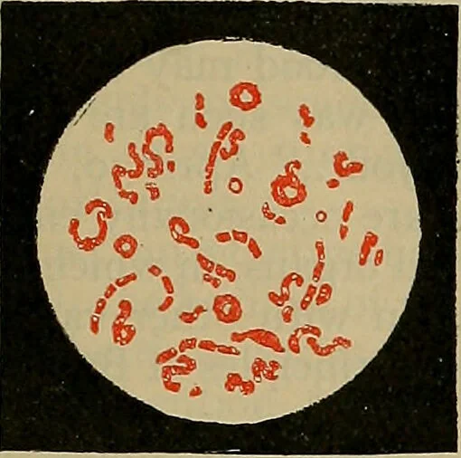 An illustration from Modern surgery, general and operative / by John Chalmers DaCosta., 1914, leaf 55