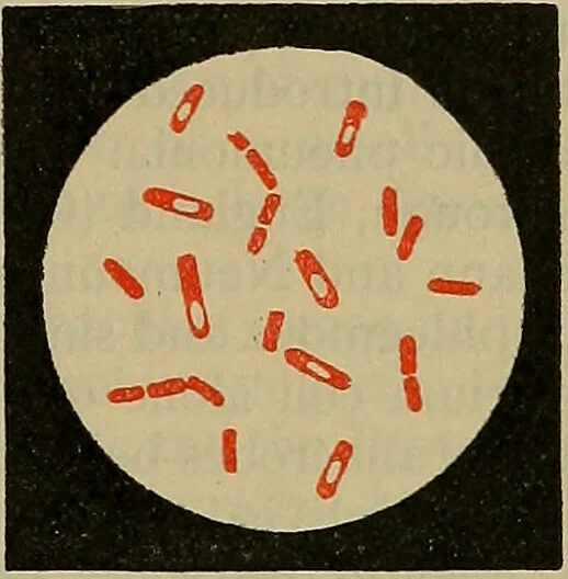 An illustration from Modern surgery, general and operative / by John Chalmers DaCosta., 1914, leaf 55