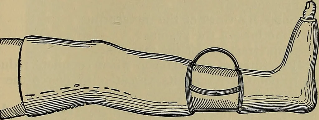 An illustration from Modern surgery, general and operative / by John Chalmers DaCosta., 1914, leaf 551