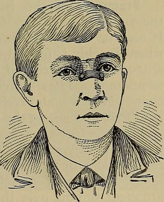 An illustration from Modern surgery, general and operative / by John Chalmers DaCosta., 1914, leaf 555