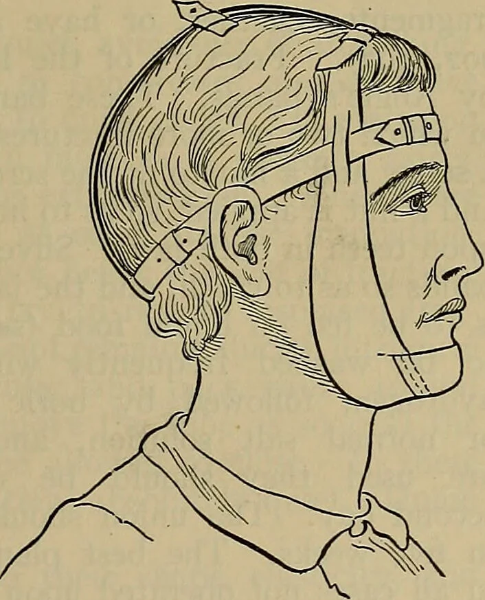 An illustration from Modern surgery, general and operative / by John Chalmers DaCosta., 1914, leaf 559