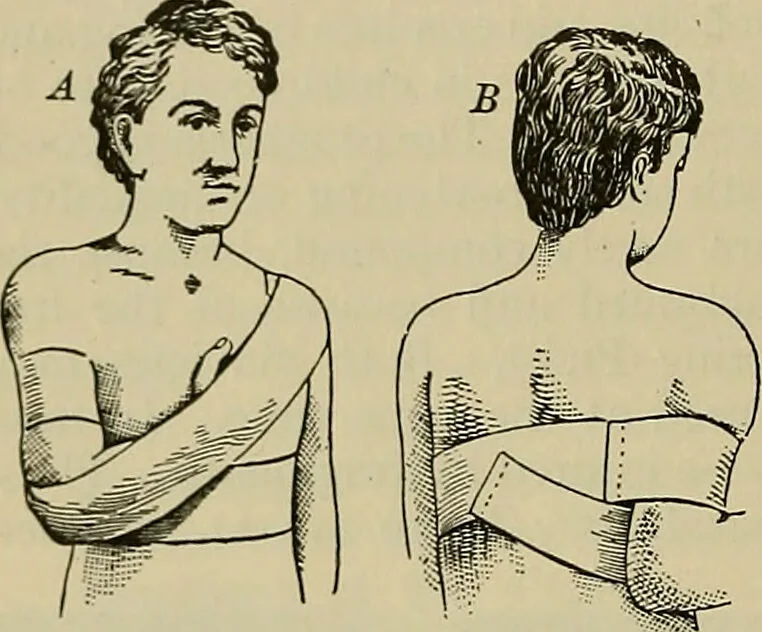 An illustration from Modern surgery, general and operative / by John Chalmers DaCosta., 1914, leaf 570