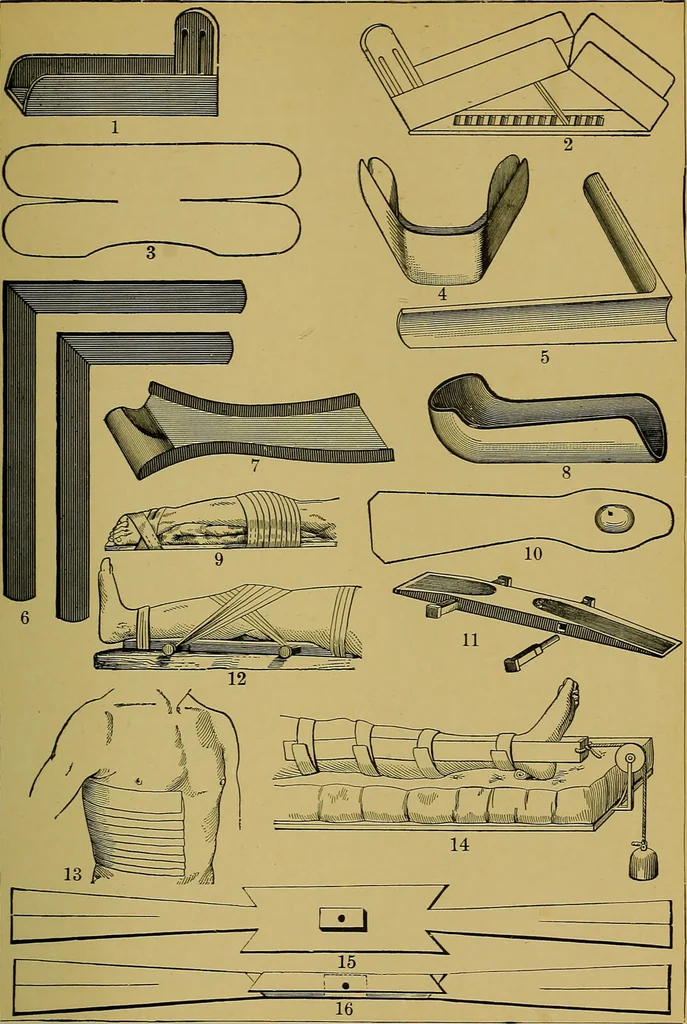 An illustration from Modern surgery, general and operative / by John Chalmers DaCosta., 1914, leaf 573