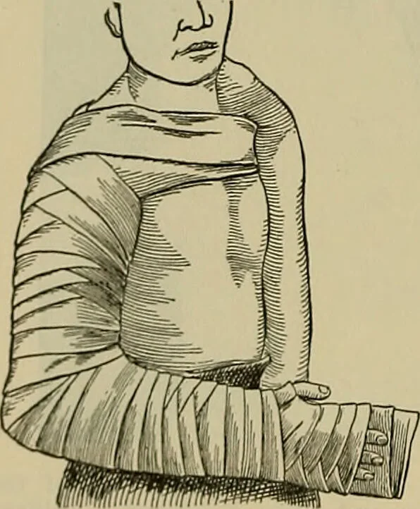 An illustration from Modern surgery, general and operative / by John Chalmers DaCosta., 1914, leaf 576