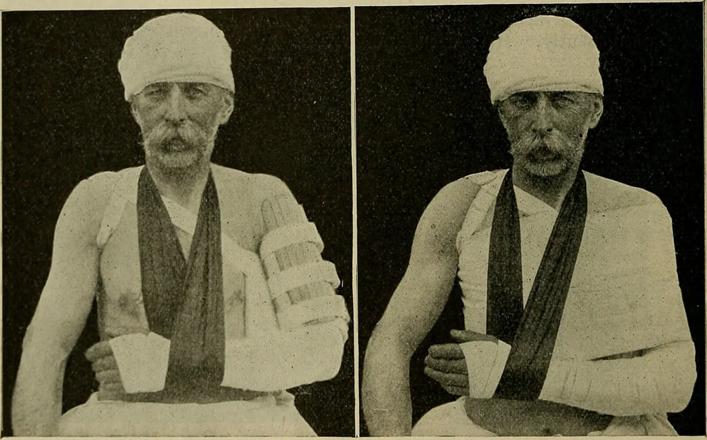 An illustration from Modern surgery, general and operative / by John Chalmers DaCosta., 1914, leaf 580