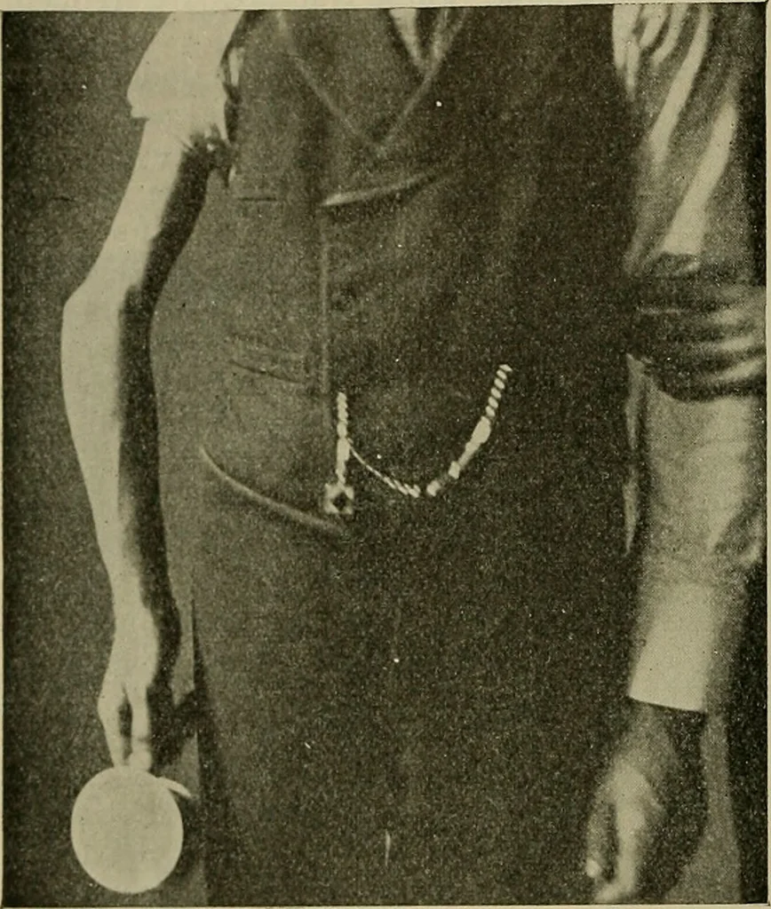 An illustration from Modern surgery, general and operative / by John Chalmers DaCosta., 1914, leaf 582