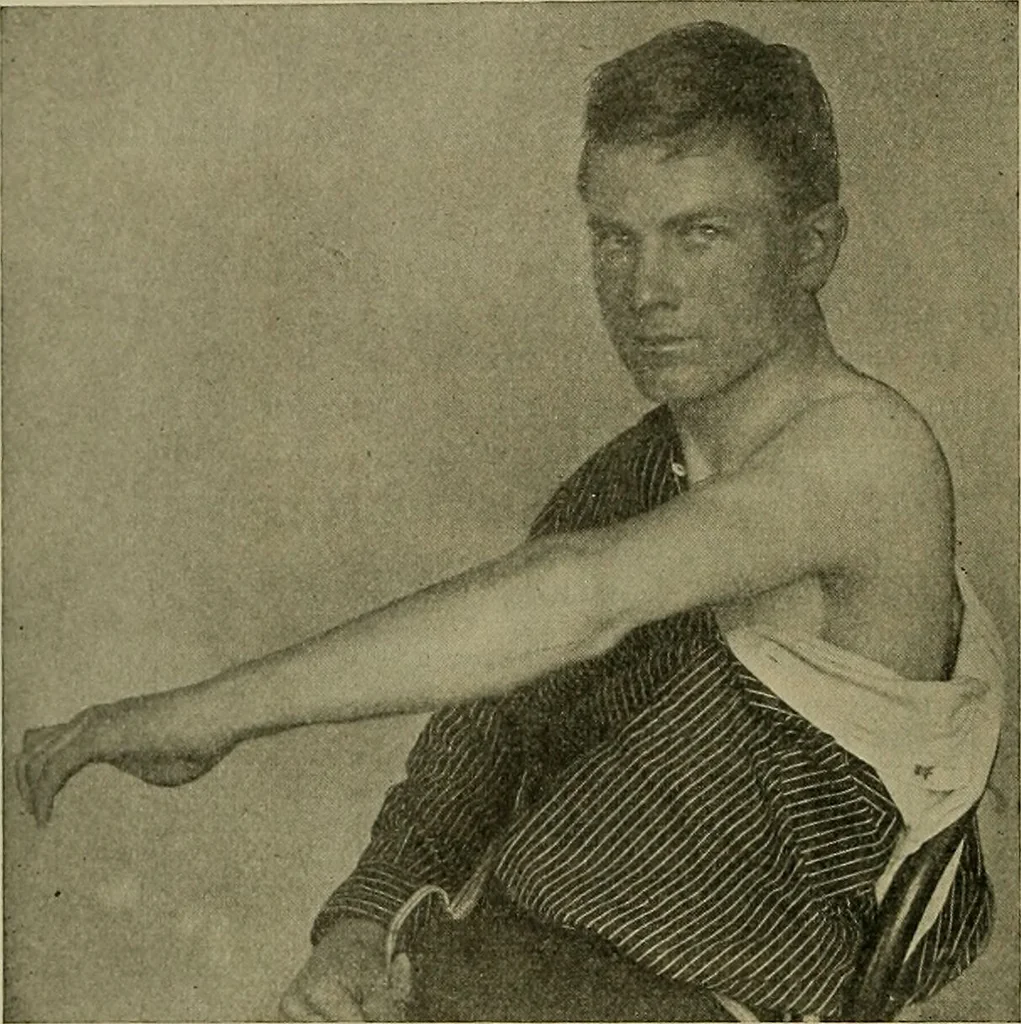 An illustration from Modern surgery, general and operative / by John Chalmers DaCosta., 1914, leaf 588