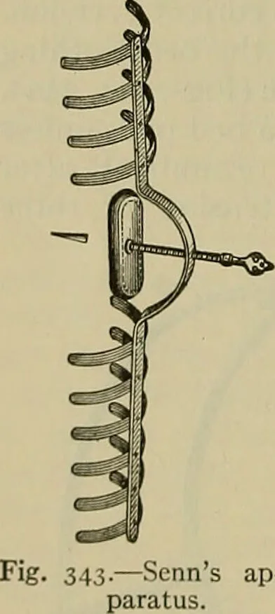 An illustration from Modern surgery, general and operative / by John Chalmers DaCosta., 1914, leaf 608