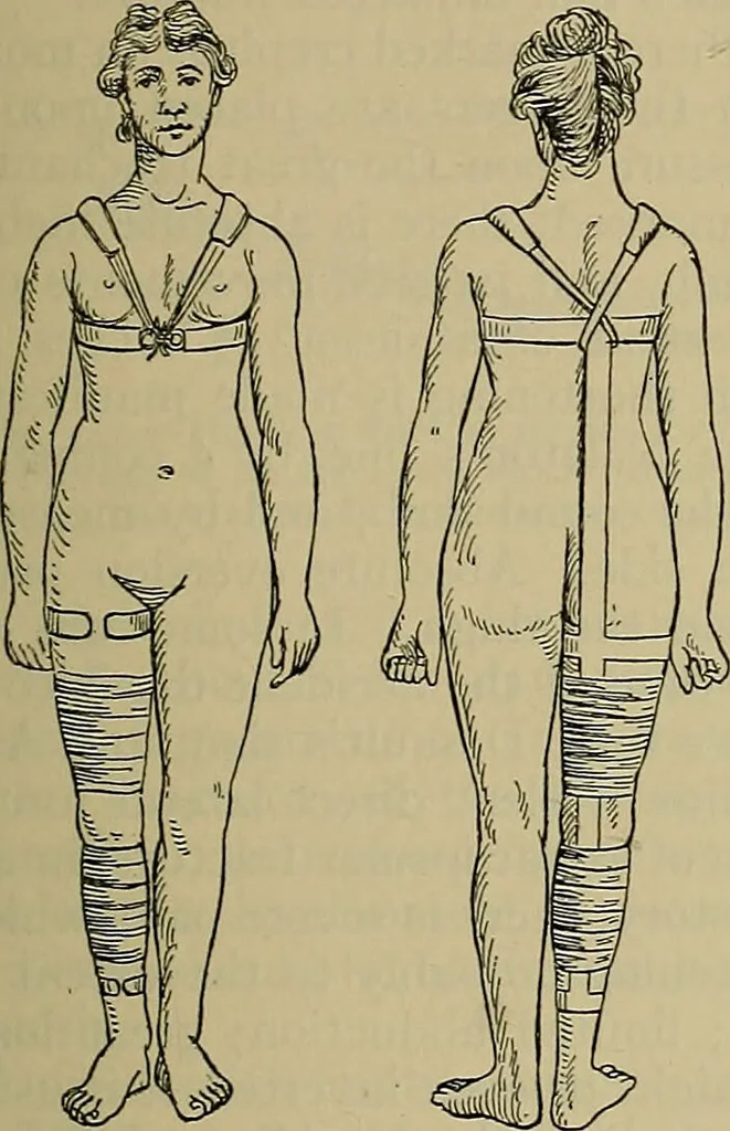 An illustration from Modern surgery, general and operative / by John Chalmers DaCosta., 1914, leaf 609