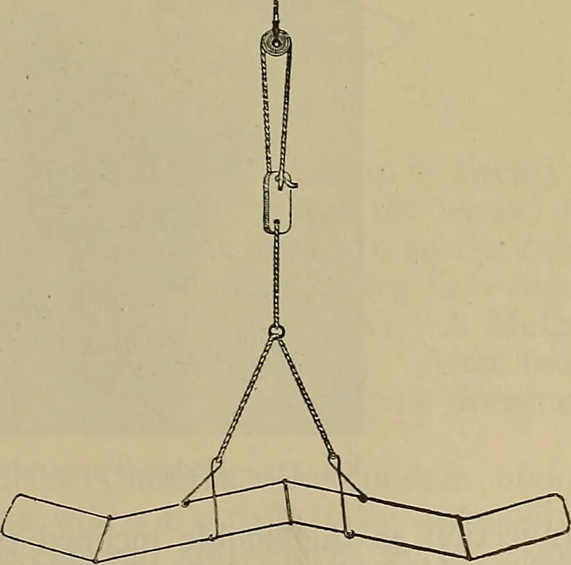 An illustration from Modern surgery, general and operative / by John Chalmers DaCosta., 1914, leaf 615