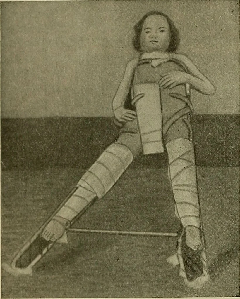 An illustration from Modern surgery, general and operative / by John Chalmers DaCosta., 1914, leaf 618