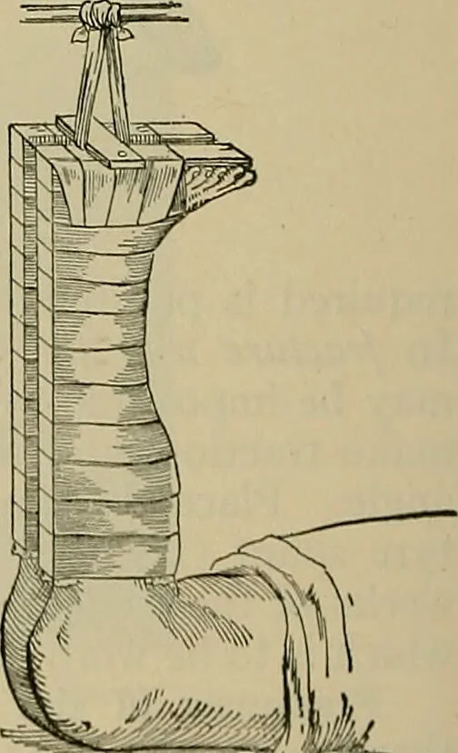 An illustration from Modern surgery, general and operative / by John Chalmers DaCosta., 1914, leaf 618