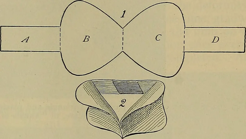An illustration from Modern surgery, general and operative / by John Chalmers DaCosta., 1914, leaf 619