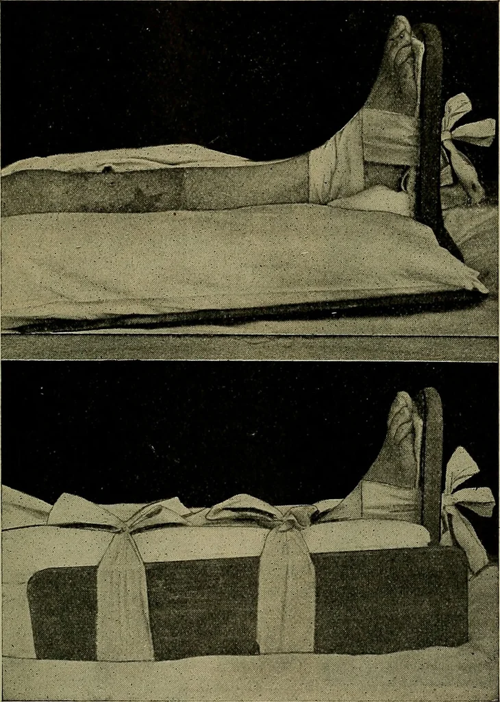 An illustration from Modern surgery, general and operative / by John Chalmers DaCosta., 1914, leaf 631