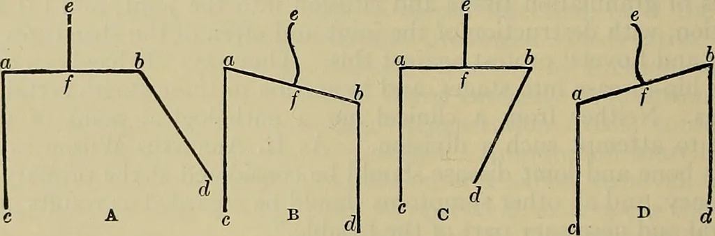An illustration from Modern surgery, general and operative / by John Chalmers DaCosta., 1914, leaf 646