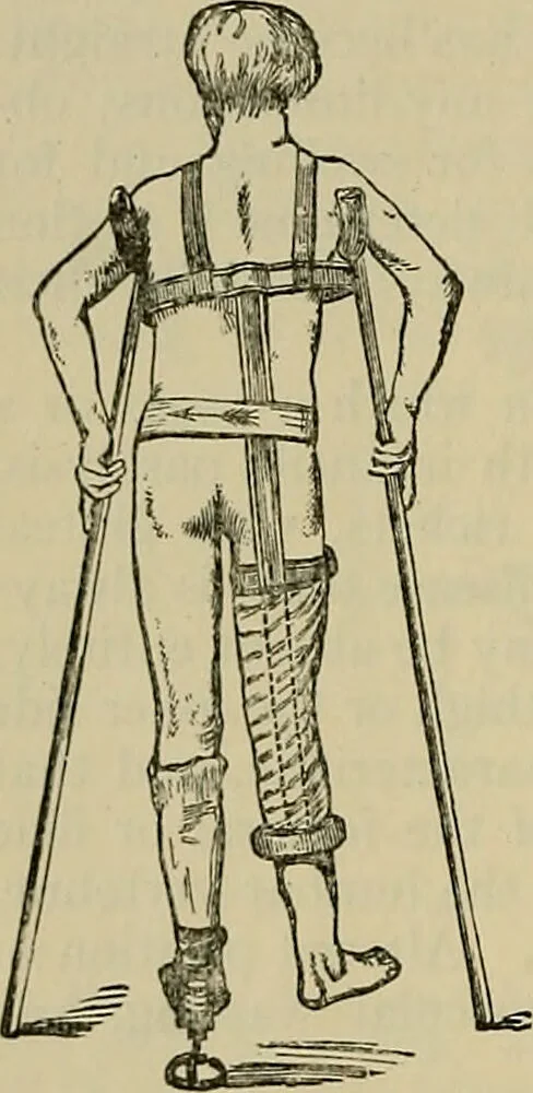 An illustration from Modern surgery, general and operative / by John Chalmers DaCosta., 1914, leaf 648