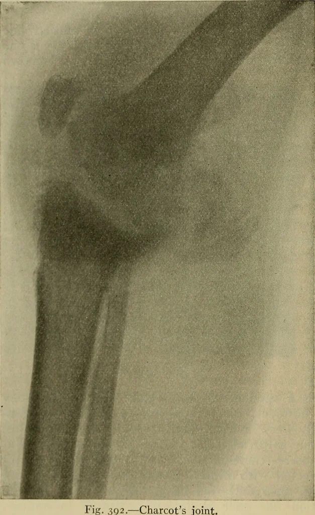 An illustration from Modern surgery, general and operative / by John Chalmers DaCosta., 1914, leaf 666