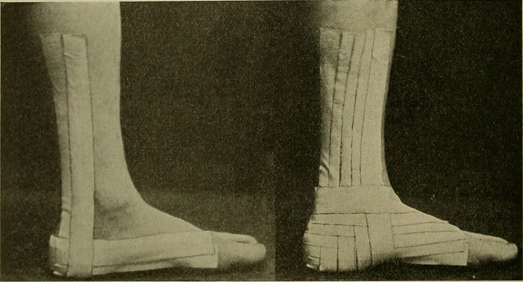 An illustration from Modern surgery, general and operative / by John Chalmers DaCosta., 1914, leaf 670