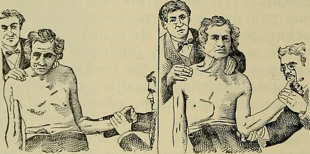 An illustration from Modern surgery, general and operative / by John Chalmers DaCosta., 1914, leaf 688