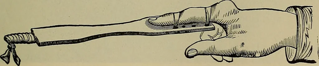 An illustration from Modern surgery, general and operative / by John Chalmers DaCosta., 1914, leaf 697