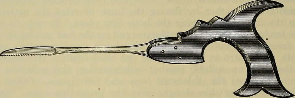 An illustration from Modern surgery, general and operative / by John Chalmers DaCosta., 1914, leaf 710