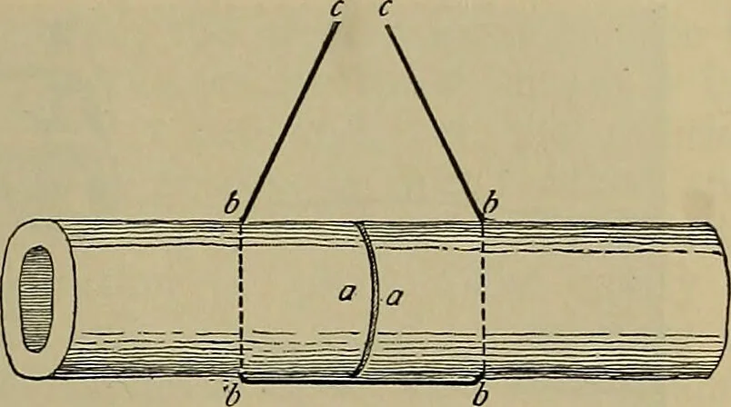 An illustration from Modern surgery, general and operative / by John Chalmers DaCosta., 1914, leaf 715