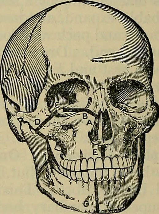 An illustration from Modern surgery, general and operative / by John Chalmers DaCosta., 1914, leaf 730