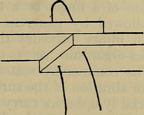An illustration from Modern surgery, general and operative / by John Chalmers DaCosta., 1914, leaf 745