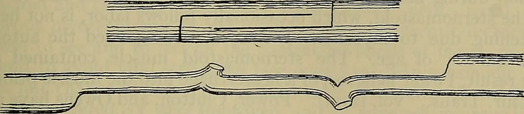 An illustration from Modern surgery, general and operative / by John Chalmers DaCosta., 1914, leaf 757