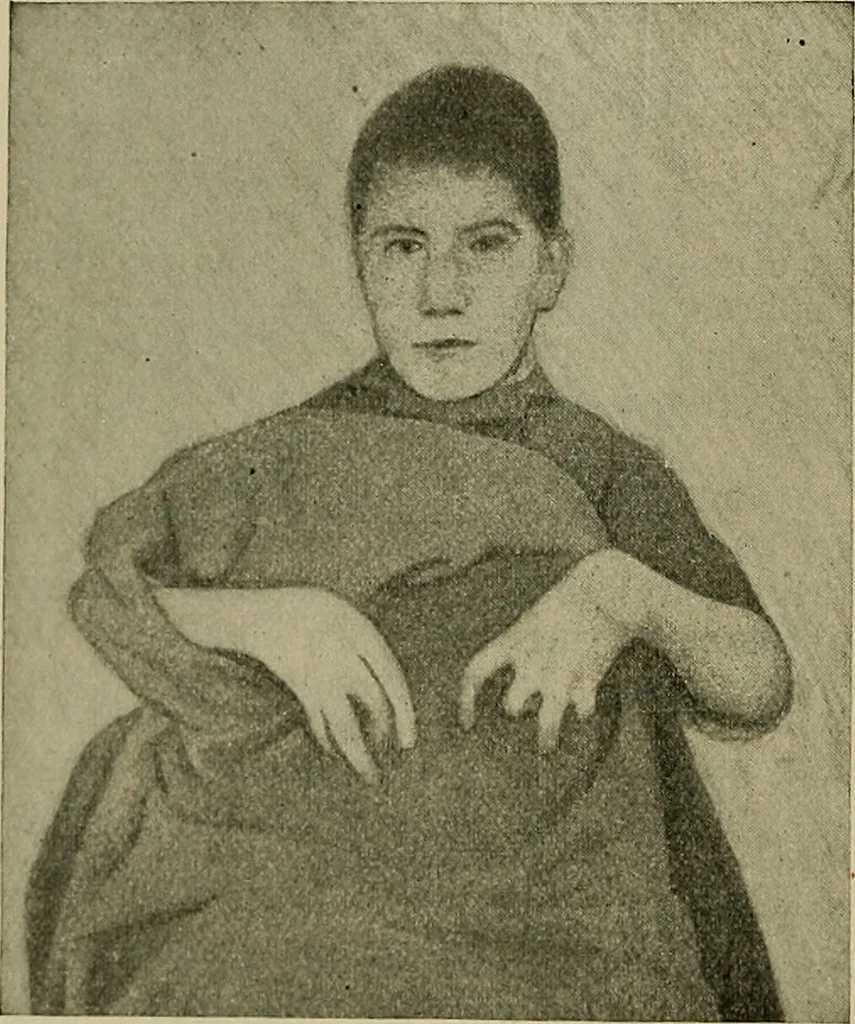 An illustration from Modern surgery, general and operative / by John Chalmers DaCosta., 1914, leaf 762