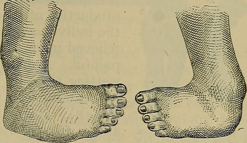 An illustration from Modern surgery, general and operative / by John Chalmers DaCosta., 1914, leaf 763