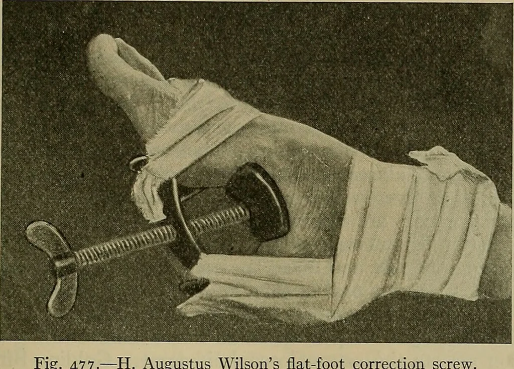 An illustration from Modern surgery, general and operative / by John Chalmers DaCosta., 1914, leaf 765