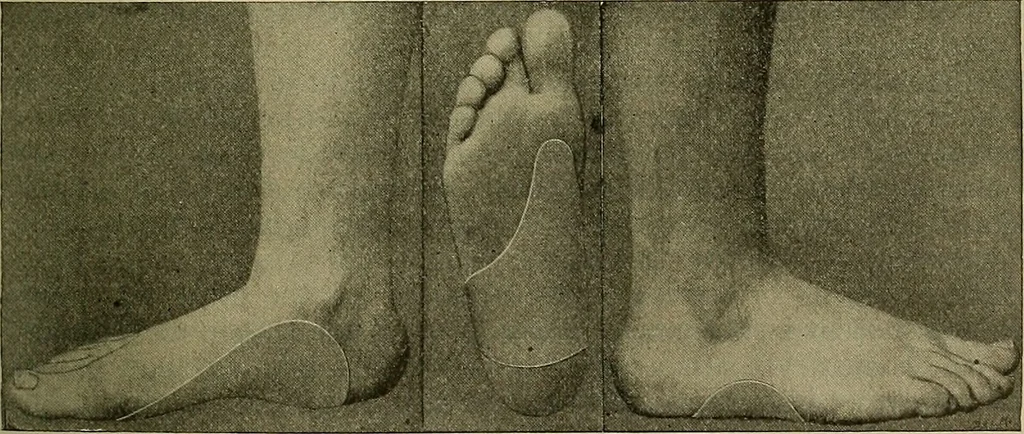 An illustration from Modern surgery, general and operative / by John Chalmers DaCosta., 1914, leaf 765